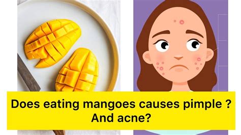 Does Eating Mangoes Causes Acne کیا آم کھانے سے ایکنی اور پمپلز