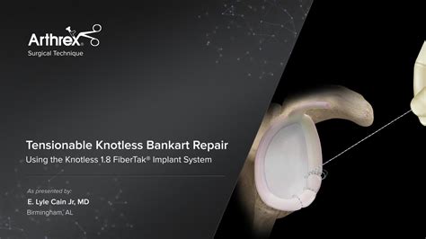 Arthrex Tensionable Knotless Bankart Repair Using The Knotless 18