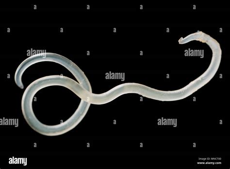 A Parasitic Nematode Or Roundworm That Has Been Removed From The