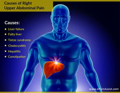 Organs associated with left side of body beneath anterior rib cage are colon and spleen. What Can Cause Upper Abdominal Pain?