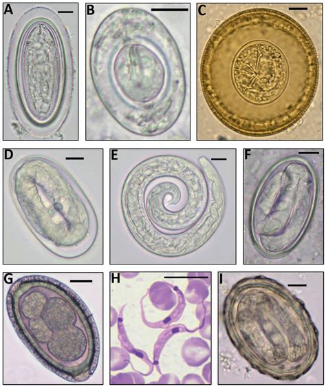 Helminth Eggs And Larva The Protozoan Blood Parasite Found Scale