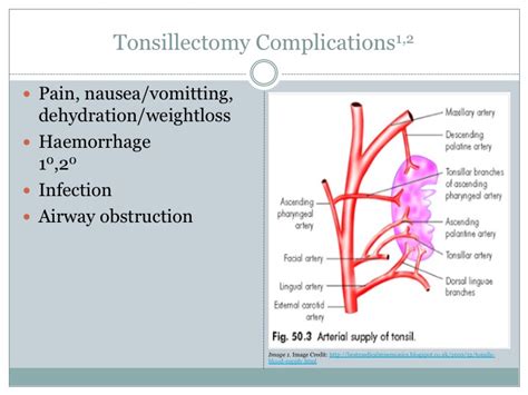 Post Tonsillectomy Bleed — Learned