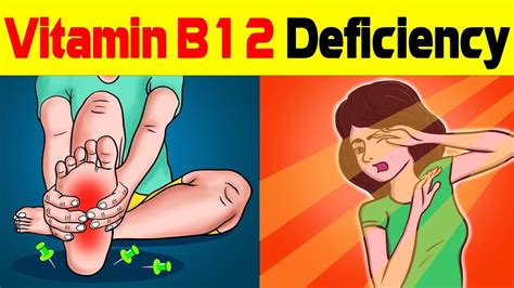 vitamin b12 deficiency symptoms b12 deficiency all you need to know youtube