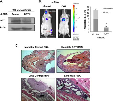 Ogt Depletion Inhibits Prostate Cancer Bone Metastasis A Pc3 Ml