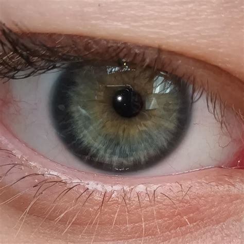 Do I Have Central Heterochromia My Mother Pointed It Out After I Told