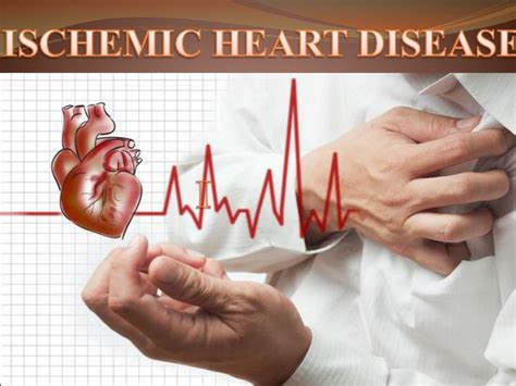 Ischemic Heart Disease Pathophysiology Ppt Pelajaran