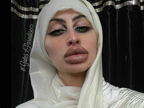 World Record Breaker She Has The Biggest Lips In The World Demotix