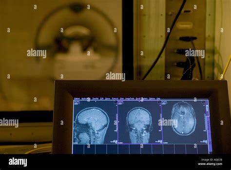 Functional Magnetic Resonance Imaging Fmri Brain Scans Of A Research