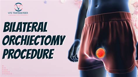 Bilateral Orchiectomy Procedure Vjs Transgender Clinic Youtube