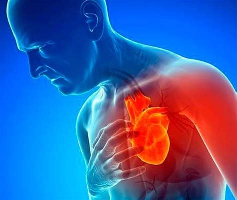 Ataque Cardíaco Síntomas Causas Tratamiento Prevención