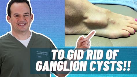 How Do You Get Rid Of A Ganglion Cyst Youtube