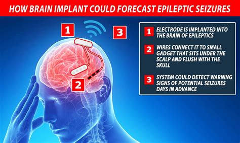 Epilepsy Warning Signs Of A Seizure The Epilepsies And Seizures Hope