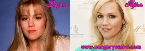 Jennie Garth Plastic Surgery Before After Pics