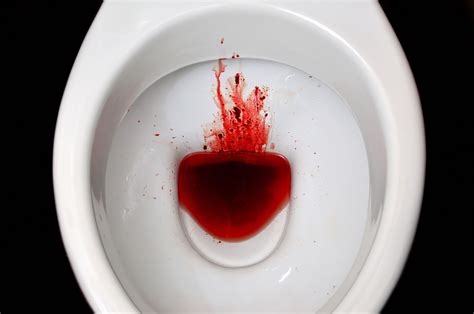 Anal Bleeding Is It Serious Porn Galleries