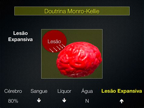 Doutrina De Monro Kellie