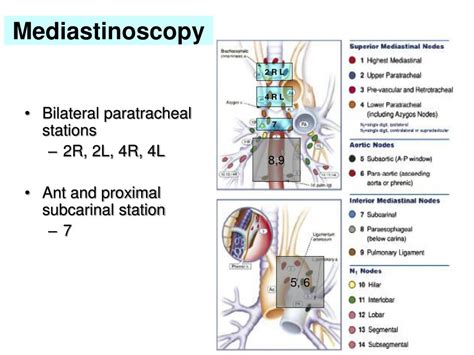 Ppt Mediastinal Staging In Lung Cancer Powerpoint Presentation Free