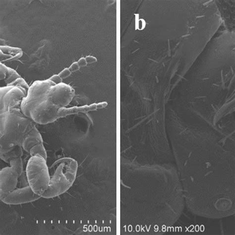 Pediculus Humanus Capitis Under Scanning Electron Microscopy SEM A