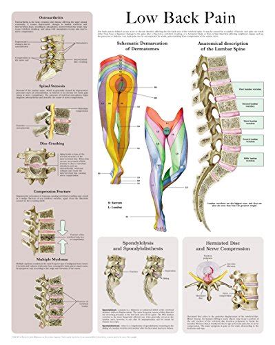 Understanding Pain Laminated Anatomical Chart Lupon Gov Ph