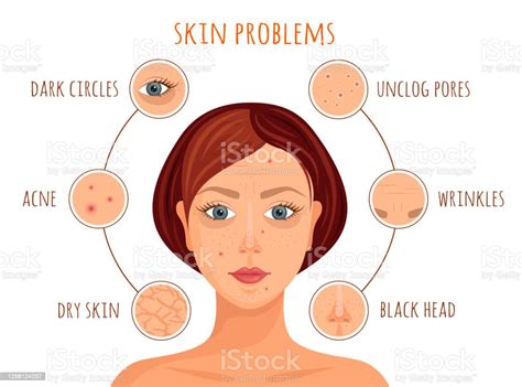 Skin Problems Infographics Vector Stock Illustration Download Image