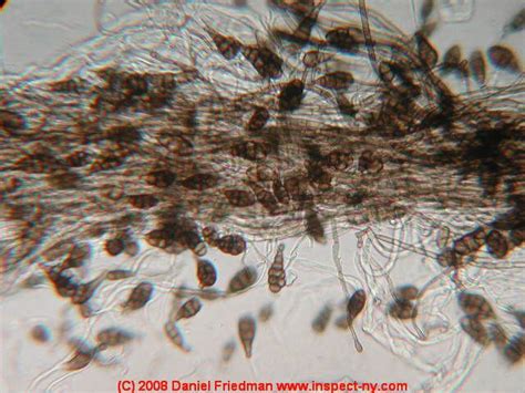 Alternaria Sp Microbiology Fungi Bacteria How To Dry Basil Dried