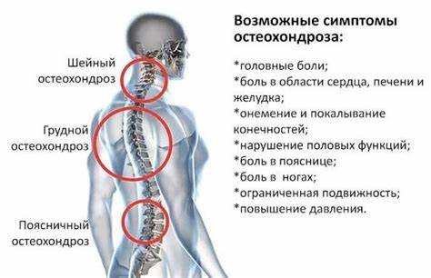 Диета для грудного остеохондроза