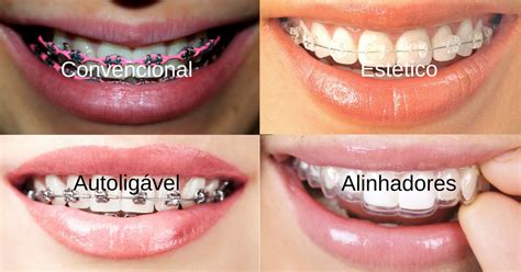 Simple Science: How to Make a Volcano with Kids