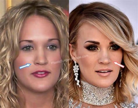 Carrie Underwood Before And After