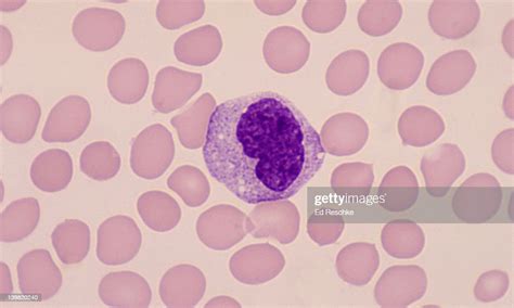 Monocyte White Blood Cell Monocytes Frequently Show A Notched Nucleus