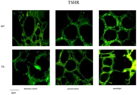 Fluorescence Immunostaining Of Thyrotropin Receptor Tshr Using