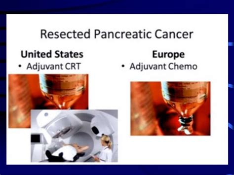 Radiotherapy Pancreatic Cancer