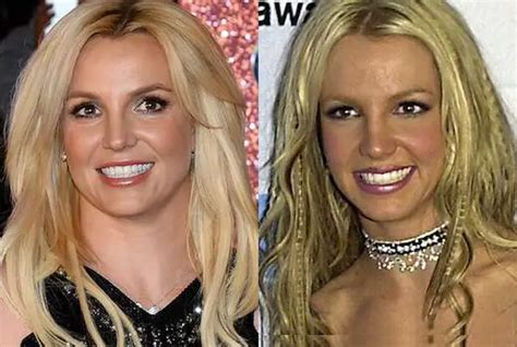 Britney Spears Plastic Surgery Before And After Celebie