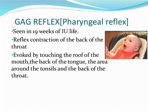 Neonatal Reflex
