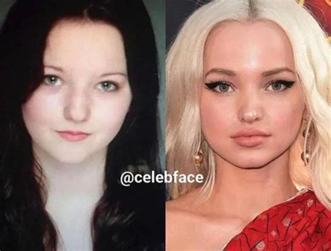 First Post Dove Cameron An All Natural Beauty Dove Cameron Lips
