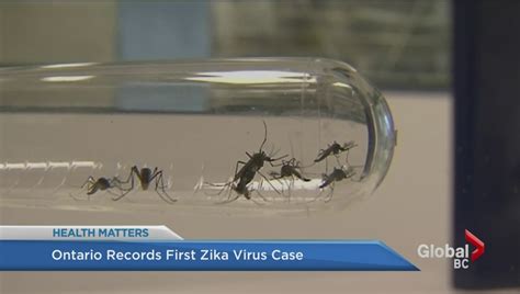 First Case Of Sexually Transmitted Zika Virus Seen In France National Globalnewsca