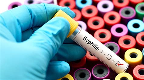 Gonorrhoea And Syphilis Cases At Record Levels In 2022