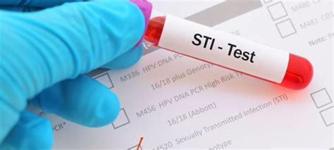 Stis And Stds All You Need To Know Bay College Lockwood Clinic