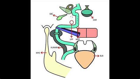 Mid Clivus Pathology Bilateral 6th Nerve Palsy Bilateral