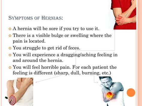 Ppt Hernia Powerpoint Presentation Free Download Id2659430