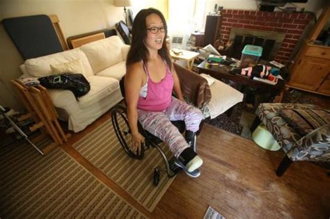For Bay Area Amputees Getting New Prostheses A Huge Headache The