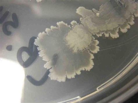 Bacillus Subtilis Bacterial Colonies Grown On Tsy Agar Science Images