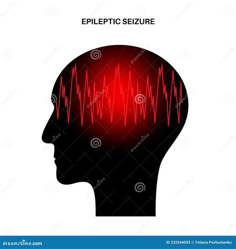 Epilepsy Headache Concept With Face Silhouette Shattered Cartoon