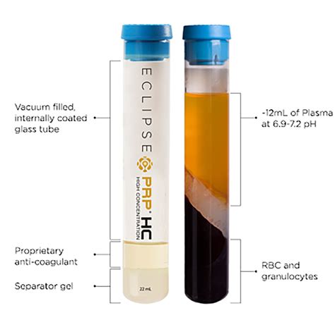 prp eclipse eclipse is the leader in platelet rich plasma systems