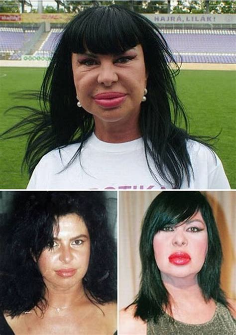 When Plastic Surgery Goes Wrong Gallery Ebaum S World