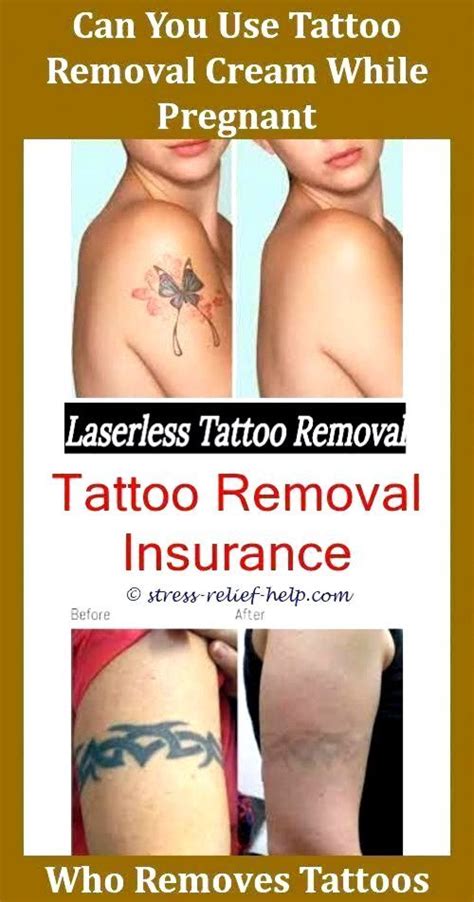 This article is a stub. Fake Tattoos How To Remove Permanent Tattoo Home Remedies ...