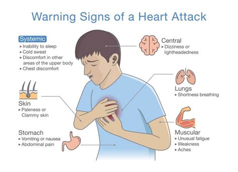 Is It Gas Pain Or A Heart Problem Bon Secours Blog Examples Pelajaran