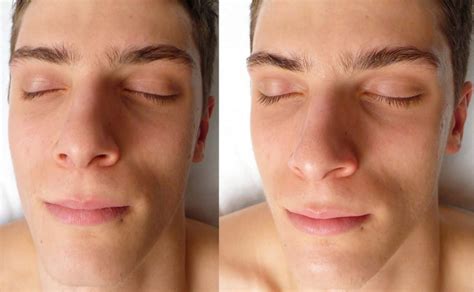 How To Repair Dead Skin Cells On Face