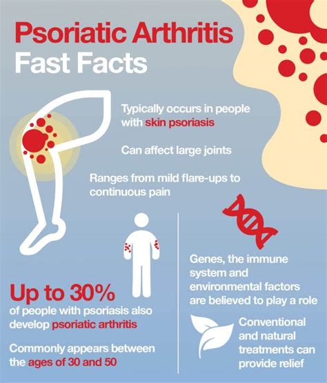 Psoriatic Arthritis Treatment 2021 Best 4 Treatment Options