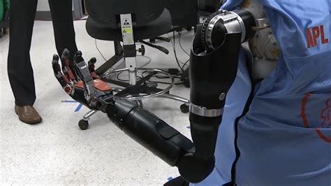 Double Amputee Controls Two Prosthetic Arms At Once Using His Mind