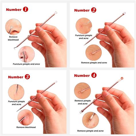 This makes your appearance look slightly unhealthy. Rose Gold Blackhead Remover Pimple Comedone Extractor Tool ...