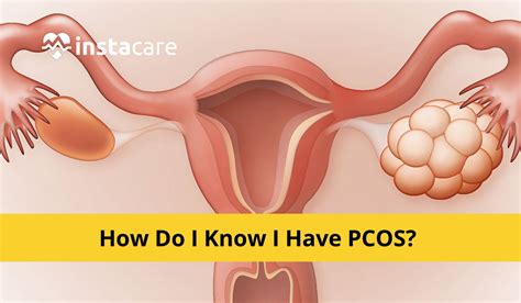 How Do I Know I Have Pcos Signs Of Pcos